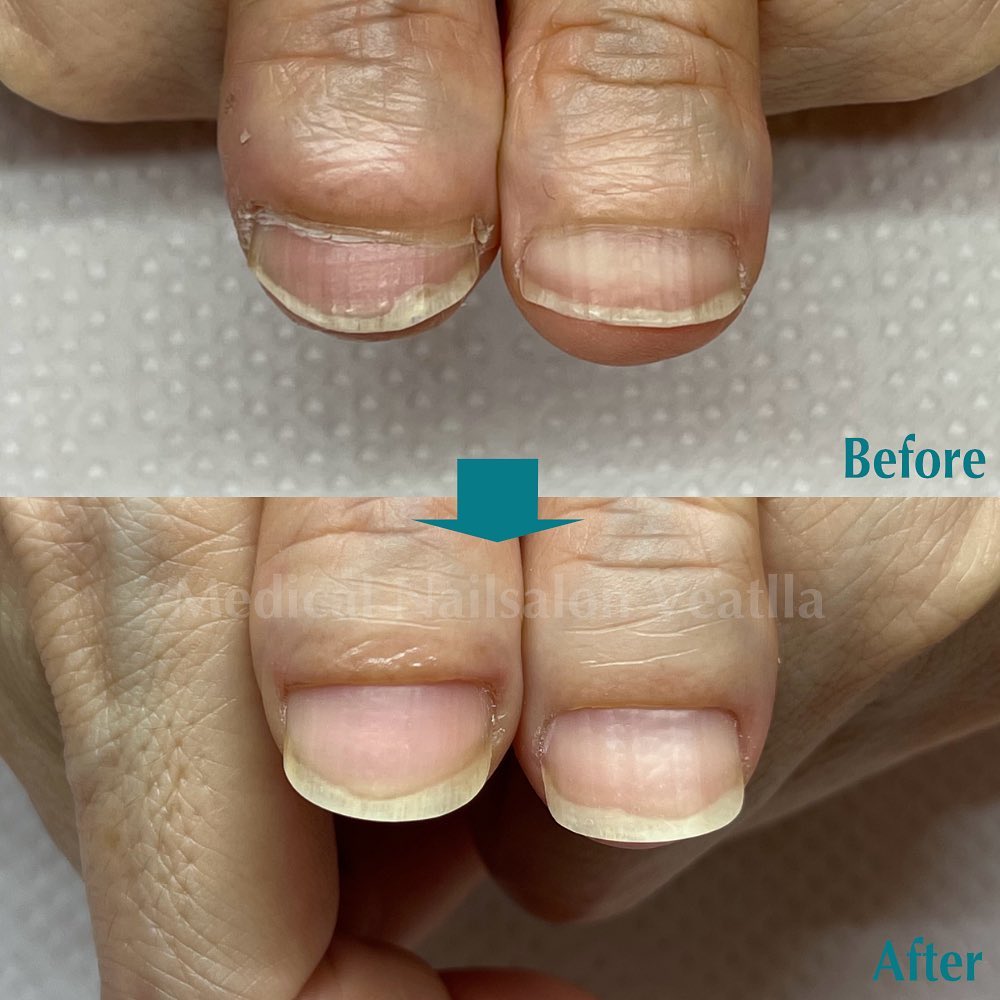 nail salon Veatlla（ネイルサロンベアトラ）｜山口市/山口南・西部の